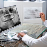 cirujano-maxilofacial
